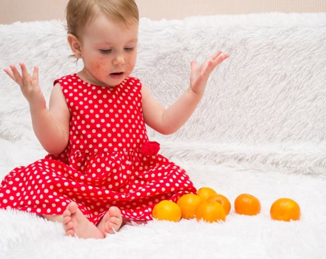 Аллергия или атопический дерматит Аллергия или атопический дерматит